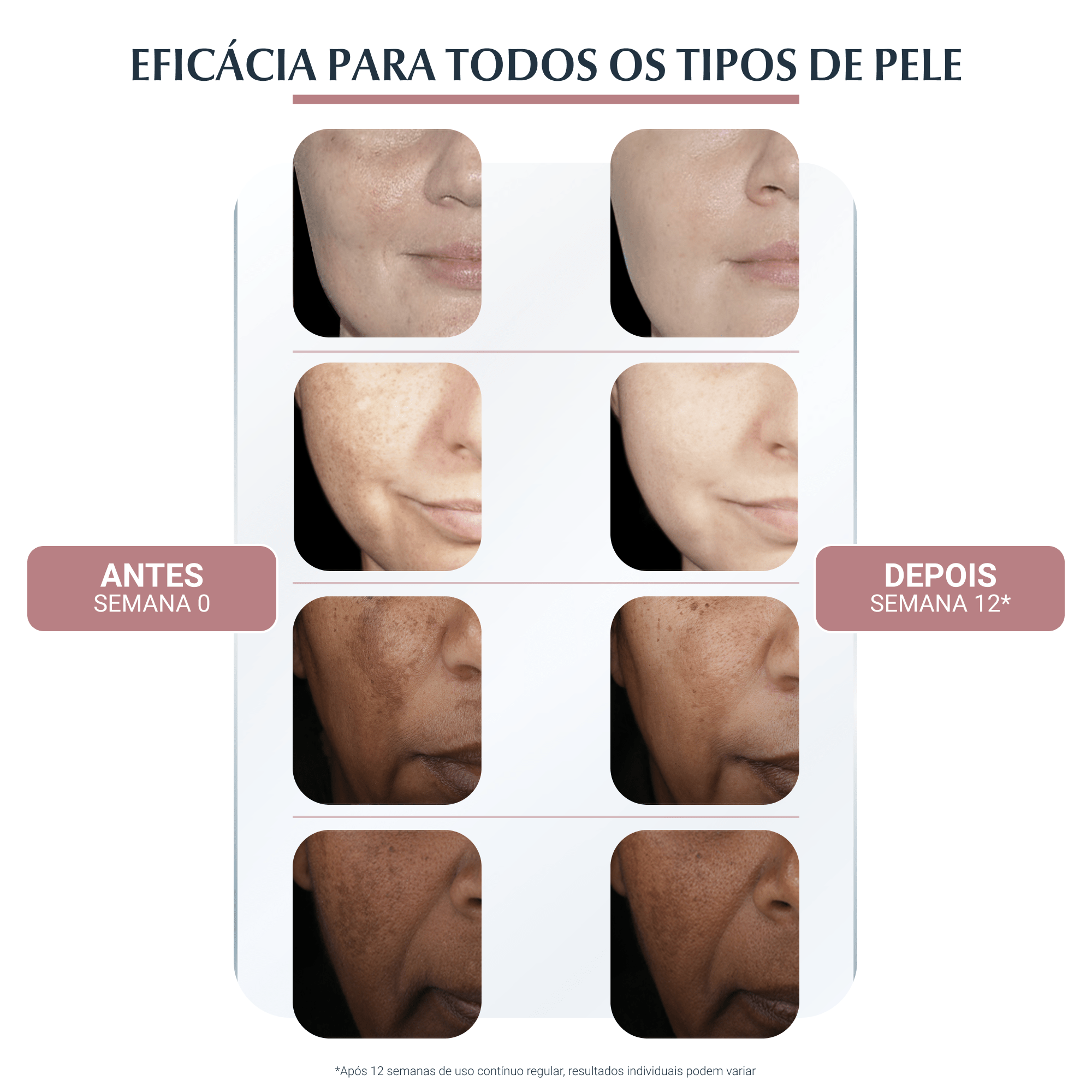 Anti-Pigment Dual Sérum | Hiperpigmentação | Eucerin Brasil
